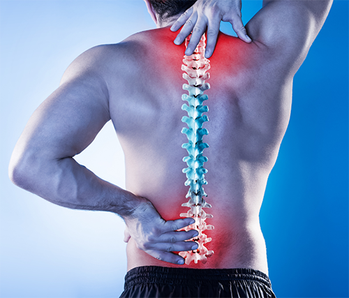 a man's back with superimposed image of an inflamed spine
